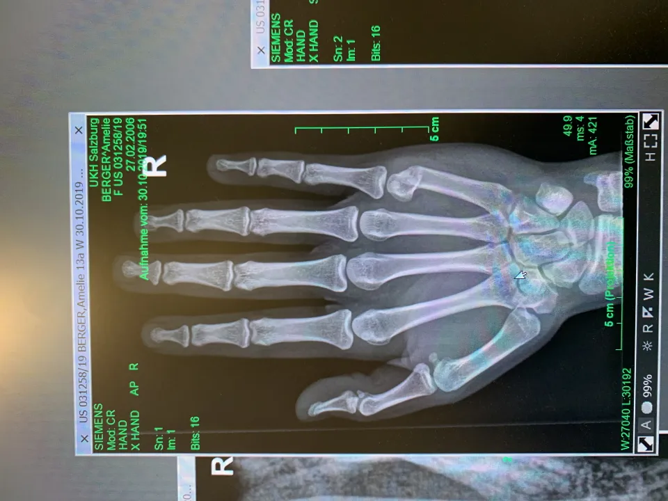 Injury Report - Amelie Berger